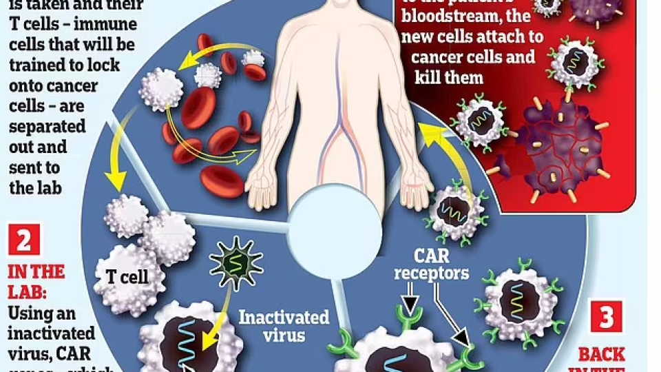 A New Form of Immunotherapy Slows the Progression of a Deadly Blood Cancer